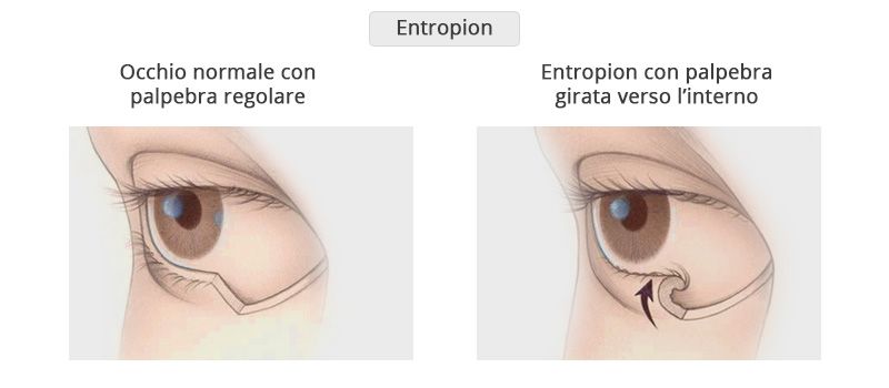 cura calazio, blefarite, entropion, ectropion, pinguecola Firenze